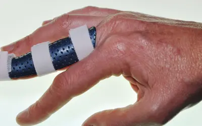 Hand Therapy Services